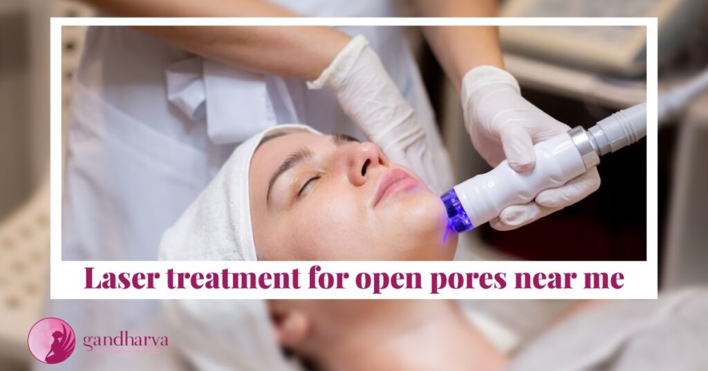 Laser treatment for open pores