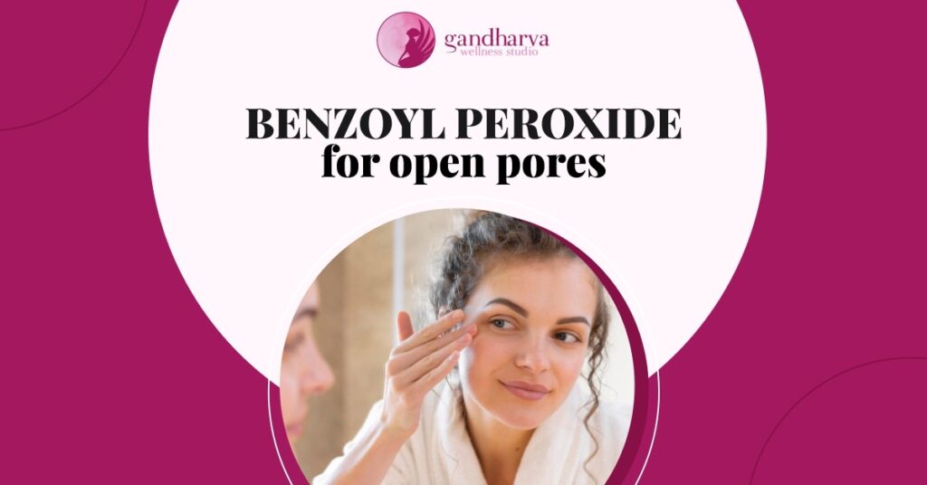 Benzoyl peroxide for open pores