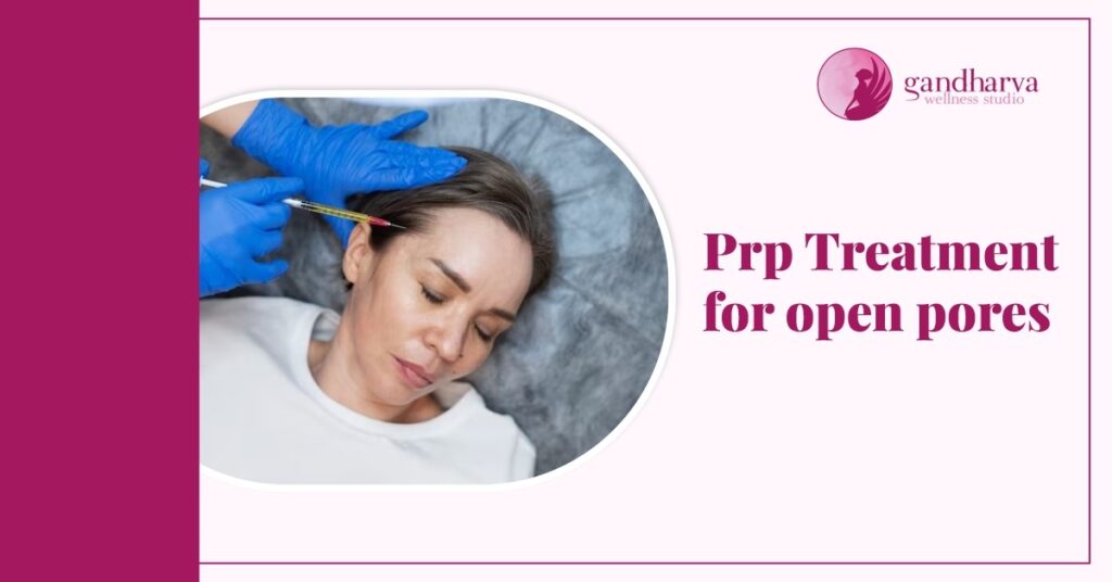 PRP Treatment for Open Pores