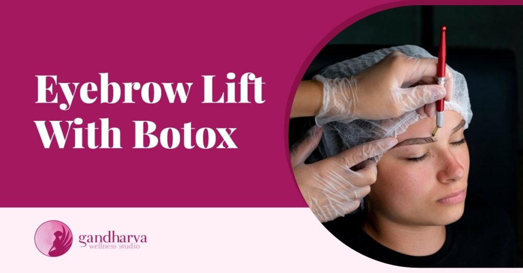 Eyebrow Lift With Botox